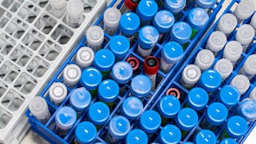 FILE PHOTO: Samples are logged at RealTime Laboratories before testing for the coronavirus disease (COVID-19) in Carrollton, Texas, U.S. June 24, 2020. REUTERS/Cooper Neill/File Photo