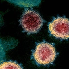 ¿Por qué el coronavirus se llama COVID-19? ¿O SARS-CoV-2?