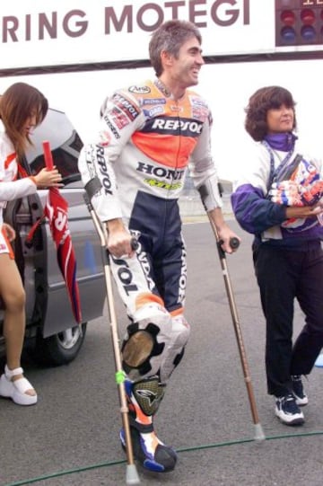 En los entrenamientos del GP de España en 1999, en el Circuito de Jerez, Doohan sufrió un grave accidente que dañó su maltrecha pierna derecha. Este accidente supuso su adiós definitivo al final de esa misma temporada. En la imagen, con muletas en una exhibición en Motegi.