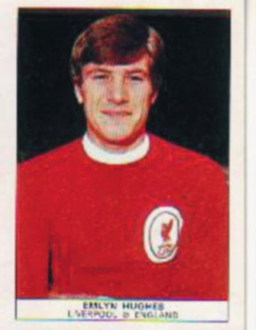 665 partidos con los reds, fue el capit芍n que levant車 la primera Copa de Europa del Liverpool. Gran car芍cter, tambi谷n jug車 durante una 谷poca de central formando t芍ndem junto a Phil Thomson.