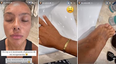 Katerina Safarova, desesperada por sus secuelas tras Supervivientes: ?Cmo puedo estar as? 