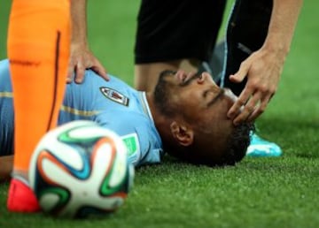 Álvaro Pereira se llevó un fuerte golpe.