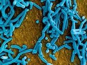 Virus Marburgo: síntomas, cómo se contagia y qué riesgos tiene