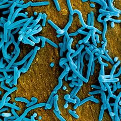 La OMS teme por el Virus de Marburg