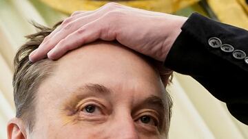 Elon Musk shows a bruised eye that Musk claimed he received at the hands of his son, X Æ A-12, as he attends a press conference with U.S. President Donald Trump in the Oval Office at the White House in Washington, D.C., U.S., May 30, 2025. REUTERS/Nathan Howard
