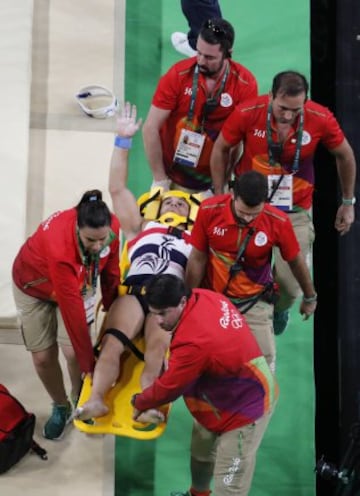 El gimnasta francés se fracturó la tibia de su pierna izquierda tras un mal salto. Sus compañeros no lo pedían creer. La peor imagen de Río 2016.