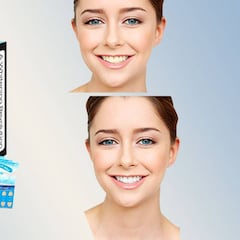 Consigue unos dientes blancos con este kit que es superventas en Amazon