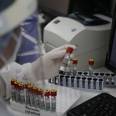 Viruela del mono en Jalisco: Cuántos casos van y qué es lo último que se ha dicho