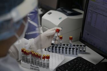 Aumentan los casos de viruela del mono en CDMX: recomendaciones para evitar posibles contagios