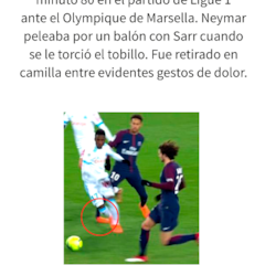 El gráfico que explica cómo es la lesión de Neymar