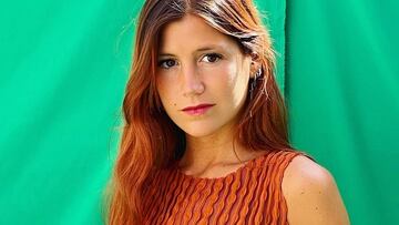 Miri, de ‘MasterChef 5′, muestra las secuelas de su grave accidente de tráfico