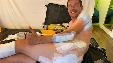Primoz Roglic muestra las vendas sobre las heridas que se produjo tras su caída en la tercera etapa del Tour de Francia.