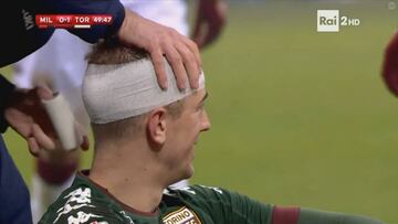 Torino's Joe Hart takes studs to the head...plays on!