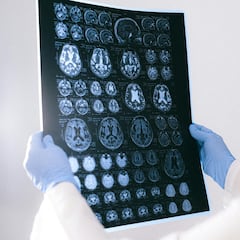 La ciencia consigue predecir el envejecimiento de las personas a partir de imágenes cerebrales