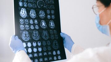 Mujer médico sujetando entre sus manos y observando una radiografía del cerebro