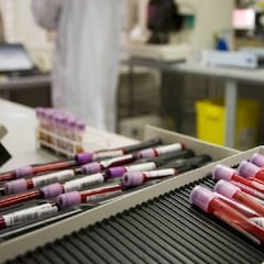 Promising breakthrough in early cancer detection