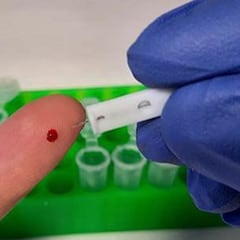 El CSIC crea un test para detectar anticuerpos de COVID-19 con una fiabilidad del 99%