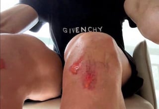 “Mis compañeros me dijeron: ‘No hagas eso, no estás en Europa”