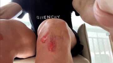 “Mis compañeros me dijeron: ‘No hagas eso, no estás en Europa”