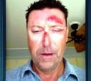 Robert Allenby secuestrado y robado en un bar de Hawai