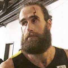 Datome, con una brecha por un objeto tirado desde la grada