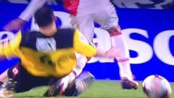 Alarmante lesión de Falcao en la rodilla; puede afectar al cruzado