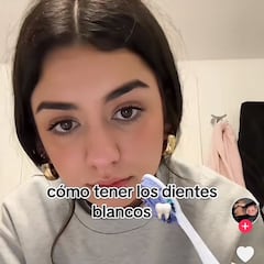 Varios odontólogos avisan del producto de moda para blanquear los dientes: “Daña el esmalte”