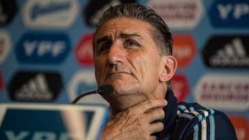 Bauza: "Debo sacarles de la cabeza las finales perdidas con Chile"