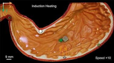 Robots de metal líquido, las nuevas herramientas en medicina e ingeniería