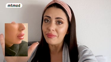 Rosario muestra imágenes con el rostro desfigurado por un retoque estético