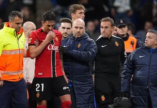 Antonio Raíllo, con fractura de pómulo, pasará por el quirófano