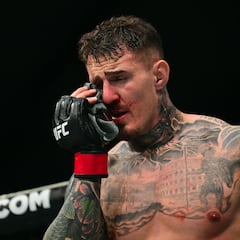 Tom Aspinall, contra las cuerdas por su ojo: “Podría no volver a pelear nunca”