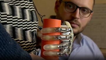Las pr車tesis del futuro devolver芍n el tacto a sus due?os