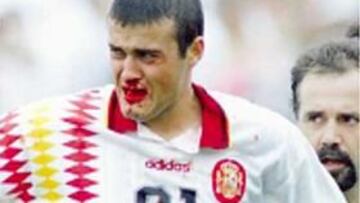 <b>EE UU 1994: LA SANGRE DE LUIS ENRIQUE</b> Con un cabezazo nos metimos en el Mundial: el de Hierro a Dinamarca previa falta de Bakero a Schmeichel en Sevilla. Y con un codazo salimos de él: el de Tassotti a Luis Enrique en los cuartos.