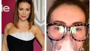 Alyssa Milano, sobre el coronavirus: “Creía que me moría”