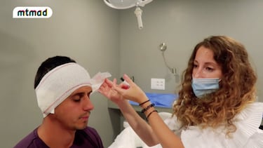 Christofer se somete a una ciruga para solucionar el complejo de sus orejas