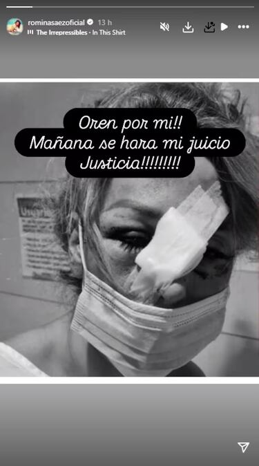 Ex chica Mekano comparte una impactante fotografía en Instagram: “Oren por mí...”