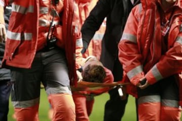 Torres suffers severe head injury