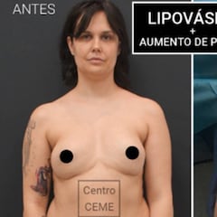 Miriam Sánchez muestra la operación estética a la que se ha sometido