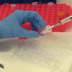 Los alimentos que disparan el cáncer de colon entre los jóvenes