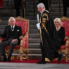 Preocupación por un aspecto de los dedos de Carlos III