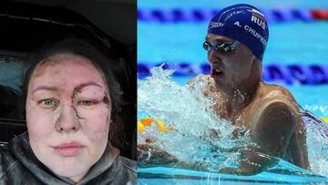 "Pensaba que moriría enterrada viva": el duro relato de Morozova