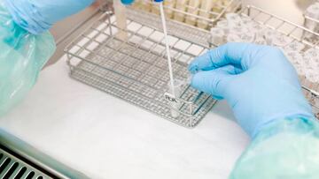 An¨¢lisis prueba PCR