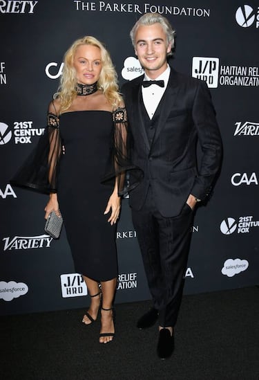 Pamela Anderson asombra al mundo tras su nuevo retoque estético