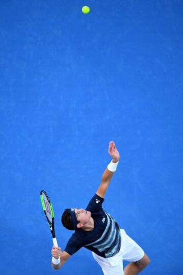 Milos Raonic en uno de sus saques potentes que terminan en ace.