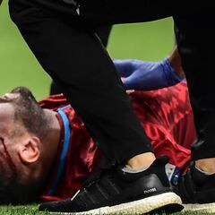 David Ospina sale con golpe y corte en la cabeza