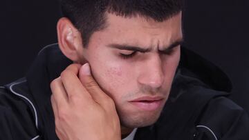 Spain's Carlos Alcaraz attends a press conference following his defeat by Serbia's Novak Djokovic in their men's singles quarterfinal match on day ten of the Australian Open tennis tournament in Melbourne early on January 22, 2025. (Photo by DAVID GRAY / AFP) / -- IMAGE RESTRICTED TO EDITORIAL USE - STRICTLY NO COMMERCIAL USE --