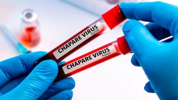 Virus Chapare: ¿qué se sabe del virus que fue detectado en Bolivia?
