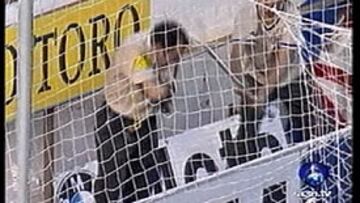 <b>CONSECUENCIAS.</b> El vigilante Antonio Orrego sufrió fractura de los huesos de la nariz y tuvo que llevar una férula quince días.