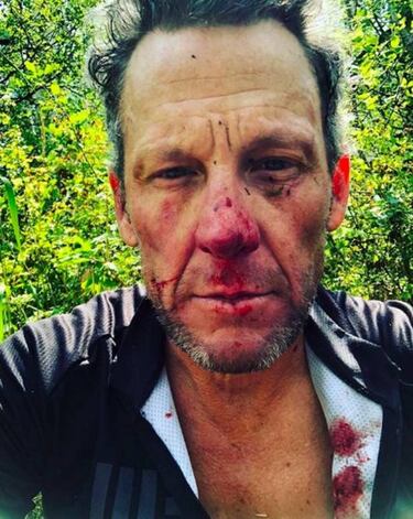 Armstrong sufre una dura ca¨ªda: su rostro lo dice todo